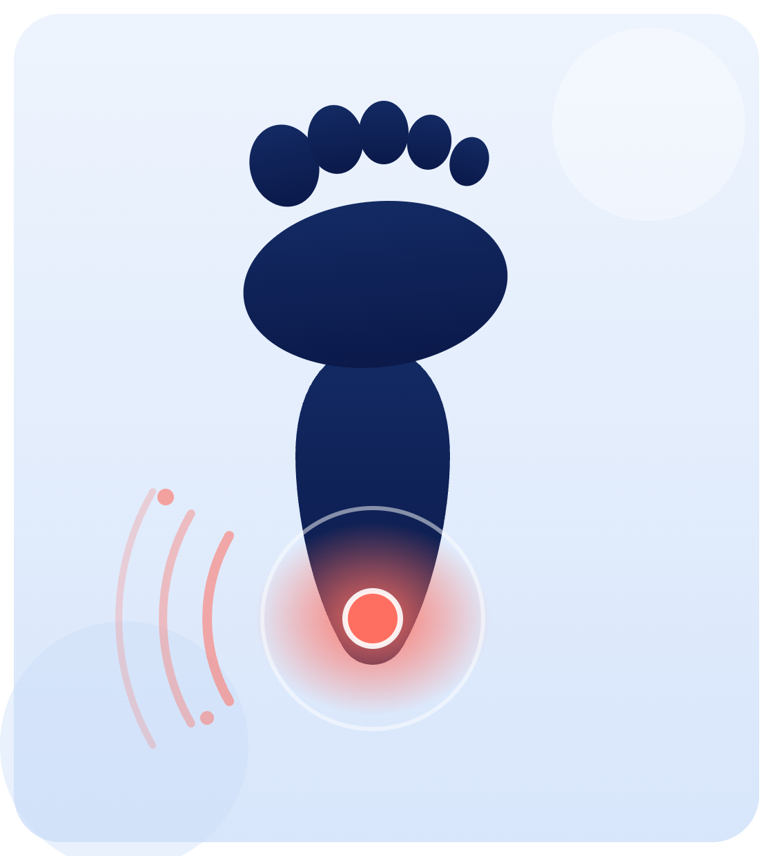 Illustration of a foot with the heel highlighted for heel pain