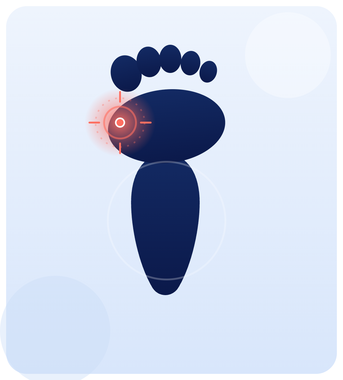 Minimally invasive foot surgery illustration